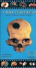 A Hole in the Head